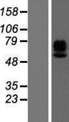 Western Blot: MAdCAM1 Overexpression Lysate (Adult Normal) [NBP2-05729] Left-Empty vector transfected control cell lysate (HEK293 cell lysate); Right -Over-expression Lysate for MAdCAM1.