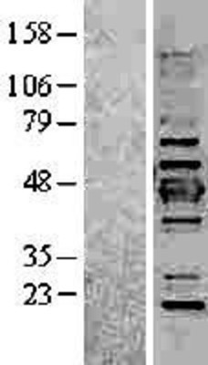 Western Blot: Cytokeratin 19 Overexpression Lysate (Adult Normal) [NBL1-12387] Left-Empty vector transfected control cell lysate (HEK293 cell lysate); Right -Over-expression Lysate for Cytokeratin 19.