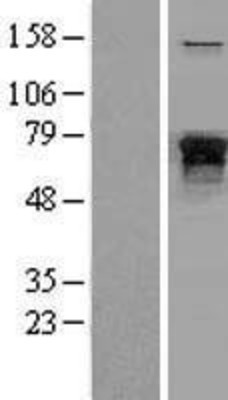 Western Blot: 68kDa Neurofilament Light Overexpression Lysate (Adult Normal) [NBL1-13577] Left-Empty vector transfected control cell lysate (HEK293 cell lysate); Right -Over-expression Lysate for 68kDa Neurofilament Light.