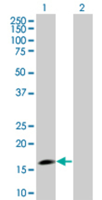 Lane 1: RGS3 transfected lysate (19.5 KDa) Lane 2: Non-transfected lysate.