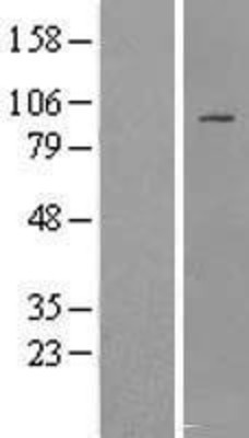 Western Blot: IFT88 Overexpression Lysate (Adult Normal) [NBL1-11864] Left-Empty vector transfected control cell lysate (HEK293 cell lysate); Right -Over-expression Lysate for IFT88.