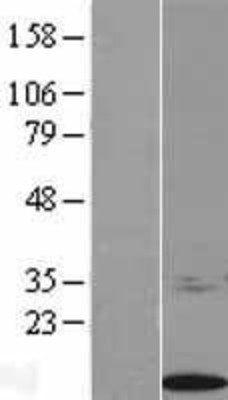 Western Blot: S100 calcium binding protein A14 Overexpression Lysate (Adult Normal) [NBL1-15652] Left-Empty vector transfected control cell lysate (HEK293 cell lysate); Right -Over-expression Lysate for S100 calcium binding protein A14.