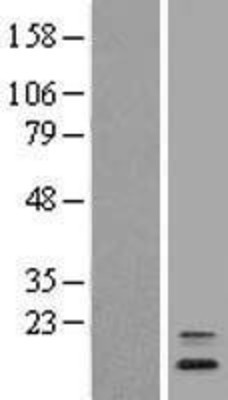 Western Blot: ANAPC16 Overexpression Lysate (Adult Normal) [NBL1-08068] Left-Empty vector transfected control cell lysate (HEK293 cell lysate); Right -Over-expression Lysate for ANAPC16.