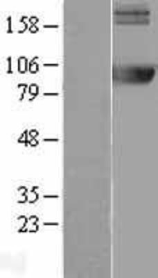 Western Blot: AMPD2 Overexpression Lysate (Adult Normal) [NBL1-07506] Left-Empty vector transfected control cell lysate (HEK293 cell lysate); Right -Over-expression Lysate for AMPD2.