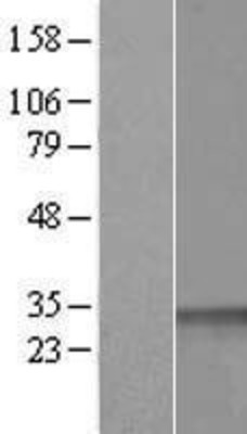 Western Blot: CCNDBP1 Overexpression Lysate (Adult Normal) [NBL1-08874] Left-Empty vector transfected control cell lysate (HEK293 cell lysate); Right -Over-expression Lysate for CCNDBP1.