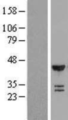 Western Blot: Tbp7 Overexpression Lysate (Adult Normal) [NBL1-14891] Left-Empty vector transfected control cell lysate (HEK293 cell lysate); Right -Over-expression Lysate for Tbp7.