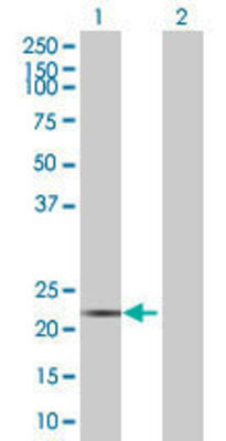 Lane 1: RPE transfected lysate (25.19 KDa) Lane 2: Non-transfected lysate.