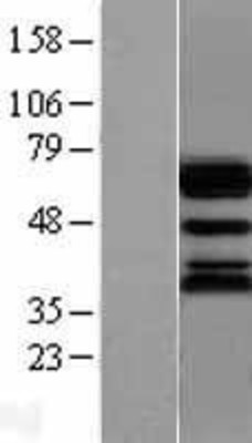 Western Blot: Ubiquilin 1 Overexpression Lysate (Adult Normal) [NBL1-17562] Left-Empty vector transfected control cell lysate (HEK293 cell lysate); Right -Over-expression Lysate for Ubiquilin 1.