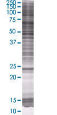 RPE transfected lysate.