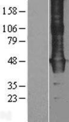 Western Blot: WDR4 Overexpression Lysate (Adult Normal) [NBL1-17803] Left-Empty vector transfected control cell lysate (HEK293 cell lysate); Right -Over-expression Lysate for WDR4.