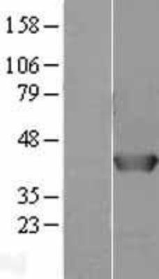 Western Blot: AHSA1 Overexpression Lysate (Adult Normal) [NBL1-07404] Left-Empty vector transfected control cell lysate (HEK293 cell lysate); Right -Over-expression Lysate for AHSA1.