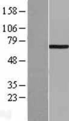 Western Blot: LIM Kinase 1 Overexpression Lysate (Adult Normal) [NBL1-12536] Left-Empty vector transfected control cell lysate (HEK293 cell lysate); Right -Over-expression Lysate for LIM Kinase 1.