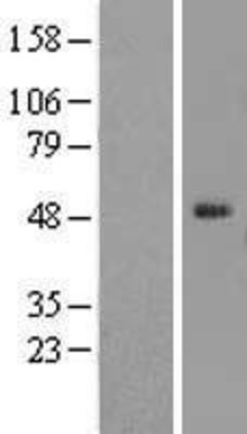 Western Blot: ELK4 Overexpression Lysate (Adult Normal) [NBL1-10235] Left-Empty vector transfected control cell lysate (HEK293 cell lysate); Right -Over-expression Lysate for ELK4.