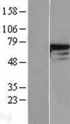Western Blot: DDX5 Overexpression Lysate (Adult Normal) [NBL1-09801] Left-Empty vector transfected control cell lysate (HEK293 cell lysate); Right -Over-expression Lysate for DDX5.