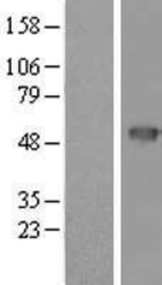 Western Blot: PSCD4 Overexpression Lysate (Adult Normal) [NBL1-14858] Left-Empty vector transfected control cell lysate (HEK293 cell lysate); Right -Over-expression Lysate for PSCD4.