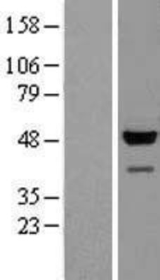 Western Blot: GAPDHS Overexpression Lysate (Adult Normal) [NBL1-10968] Left-Empty vector transfected control cell lysate (HEK293 cell lysate); Right -Over-expression Lysate for GAPDHS.