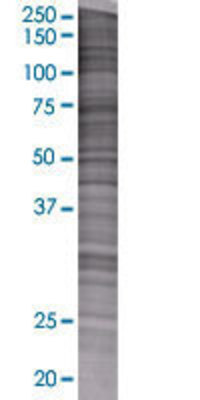 LDHAL6A transfected lysate.