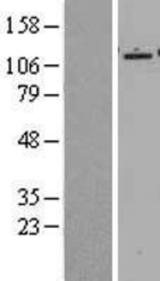Western Blot: Epac2 Overexpression Lysate (Adult Normal) [NBL1-15153] Left-Empty vector transfected control cell lysate (HEK293 cell lysate); Right -Over-expression Lysate for Epac2.