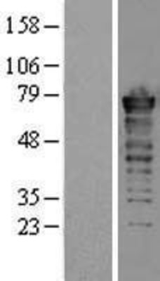 Western Blot: FUS Overexpression Lysate (Adult Normal) [NBL1-10861] Left-Empty vector transfected control cell lysate (HEK293 cell lysate); Right -Over-expression Lysate for FUS.