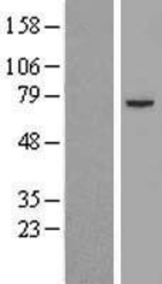 Western Blot: Pyruvate Dehydrogenase E2 Overexpression Lysate (Adult Normal) [NBL1-09906] Left-Empty vector transfected control cell lysate (HEK293 cell lysate); Right -Over-expression Lysate for Pyruvate Dehydrogenase E2.