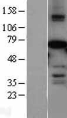 Western Blot: AF9 Overexpression Lysate (Adult Normal) [NBL1-13137] Left-Empty vector transfected control cell lysate (HEK293 cell lysate); Right -Over-expression Lysate for AF9.