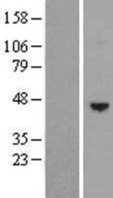 Western Blot: SCDGFB Overexpression Lysate (Adult Normal) [NBL1-14238] Left-Empty vector transfected control cell lysate (HEK293 cell lysate); Right -Over-expression Lysate for SCDGFB.