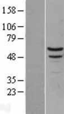 Western Blot: Myotilin Overexpression Lysate (Adult Normal) [NBL1-13445] Left-Empty vector transfected control cell lysate (HEK293 cell lysate); Right -Over-expression Lysate for Myotilin.