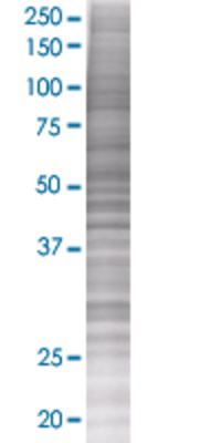 RAD23B transfected lysate.