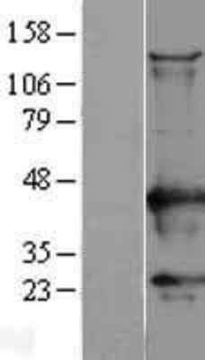 Western Blot: CaMKI Overexpression Lysate (Adult Normal) [NBL1-08658] Left-Empty vector transfected control cell lysate (HEK293 cell lysate); Right -Over-expression Lysate for CaMKI.