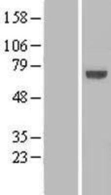 Western Blot: KLHL25 Overexpression Lysate (Adult Normal) [NBL1-12338] Left-Empty vector transfected control cell lysate (HEK293 cell lysate); Right -Over-expression Lysate for KLHL25.