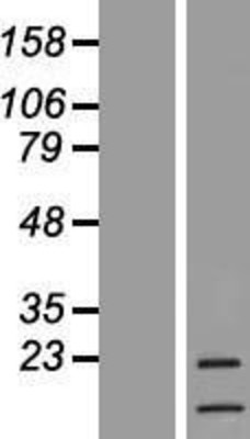 Western Blot: G-CSF Overexpression Lysate (Adult Normal) [NBL1-09518] Left-Empty vector transfected control cell lysate (HEK293 cell lysate); Right -Over-expression Lysate for G-CSF.