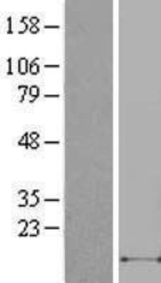 Western Blot: SDF1 Lysate [NBL1-09623]