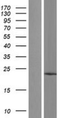 Western Blot: TMCO1 Overexpression Lysate (Adult Normal) [NBL1-16976] Left-Empty vector transfected control cell lysate (HEK293 cell lysate); Right -Over-expression Lysate for TMCO1.