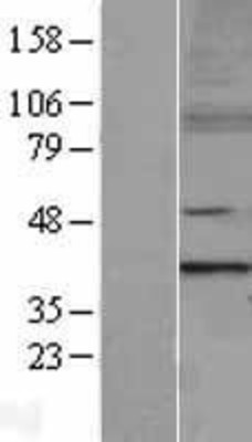 Western Blot: MTERF Overexpression Lysate (Adult Normal) [NBL1-13356] Left-Empty vector transfected control cell lysate (HEK293 cell lysate); Right -Over-expression Lysate for MTERF.