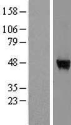 Western Blot: WDR85 Overexpression Lysate (Adult Normal) [NBL1-17833] Left-Empty vector transfected control cell lysate (HEK293 cell lysate); Right -Over-expression Lysate for WDR85.