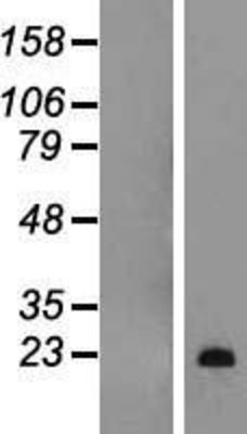 Western Blot: Myelin Basic Overexpression Lysate (Adult Normal) [NBL1-12933] Left-Empty vector transfected control cell lysate (HEK293 cell lysate); Right -Over-expression Lysate for Myelin Basic.