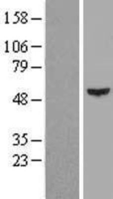 Western Blot: Cytokeratin 16 Overexpression Lysate (Adult Normal) [NBL1-12383] Left-Empty vector transfected control cell lysate (HEK293 cell lysate); Right -Over-expression Lysate for Cytokeratin 16.