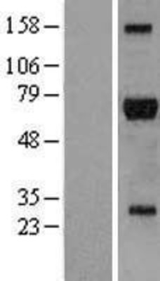 Western Blot: RIPK2 Overexpression Lysate (Adult Normal) [NBL1-15378] Left-Empty vector transfected control cell lysate (HEK293 cell lysate); Right -Over-expression Lysate for RIPK2.