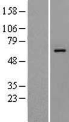 Western Blot: Glypican 4 Overexpression Lysate (Adult Normal) [NBL1-11221] Left-Empty vector transfected control cell lysate (HEK293 cell lysate); Right -Over-expression Lysate for Glypican 4.