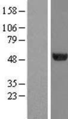 Western Blot: TUBA6 Overexpression Lysate (Adult Normal) [NBL1-17429] Left-Empty vector transfected control cell lysate (HEK293 cell lysate); Right -Over-expression Lysate for TUBA6.