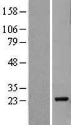 Western Blot: Pallidin Overexpression Lysate (Adult Normal) [NBL1-14498] Left-Empty vector transfected control cell lysate (HEK293 cell lysate); Right -Over-expression Lysate for Pallidin.
