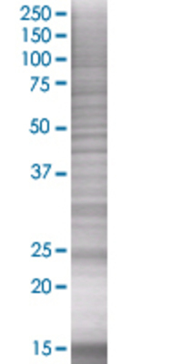 CSNK2B transfected lysate.