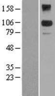 Western Blot: BACH2 Overexpression Lysate (Adult Normal) [NBL1-07899] Left-Empty vector transfected control cell lysate (HEK293 cell lysate); Right -Over-expression Lysate for BACH2.