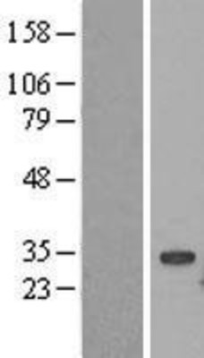 Western Blot: UBE2S Overexpression Lysate (Adult Normal) [NBL1-17544] Left-Empty vector transfected control cell lysate (HEK293 cell lysate); Right -Over-expression Lysate for UBE2S.