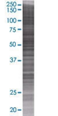 PCCB transfected lysate.