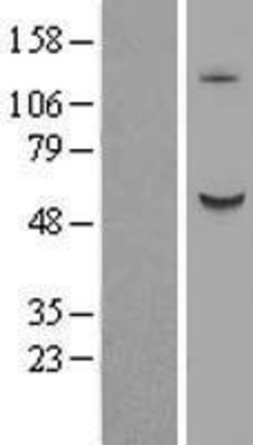 Western Blot: B3GALNT2 Overexpression Lysate (Adult Normal) [NBL1-07875] Left-Empty vector transfected control cell lysate (HEK293 cell lysate); Right -Over-expression Lysate for B3GALNT2.