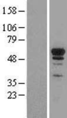 Western Blot: NRF1 Overexpression Lysate (Adult Normal) [NBL1-13789] Left-Empty vector transfected control cell lysate (HEK293 cell lysate); Right -Over-expression Lysate for NRF1.
