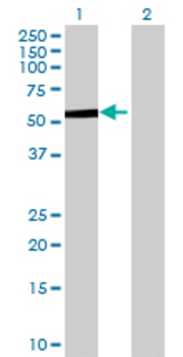 Lane 1: PCCB transfected lysate (59.4 KDa) Lane 2: Non-transfected lysate.