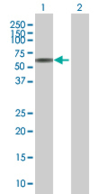 Lane 1: CAT transfected lysate (59.8 KDa) Lane 2: Non-transfected lysate.