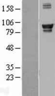 Western Blot: AMPD1 Overexpression Lysate (Adult Normal) [NBL1-07505] Left-Empty vector transfected control cell lysate (HEK293 cell lysate); Right -Over-expression Lysate for AMPD1.
